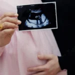 anterior placenta pregnancy ultrasound