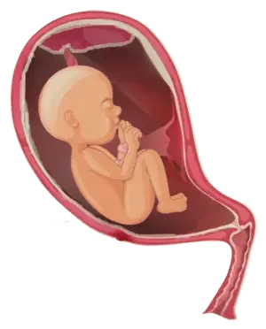 Fundal placenta