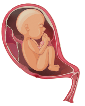 anterior placenta